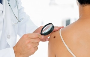 Skin_Cancer_Treatment
