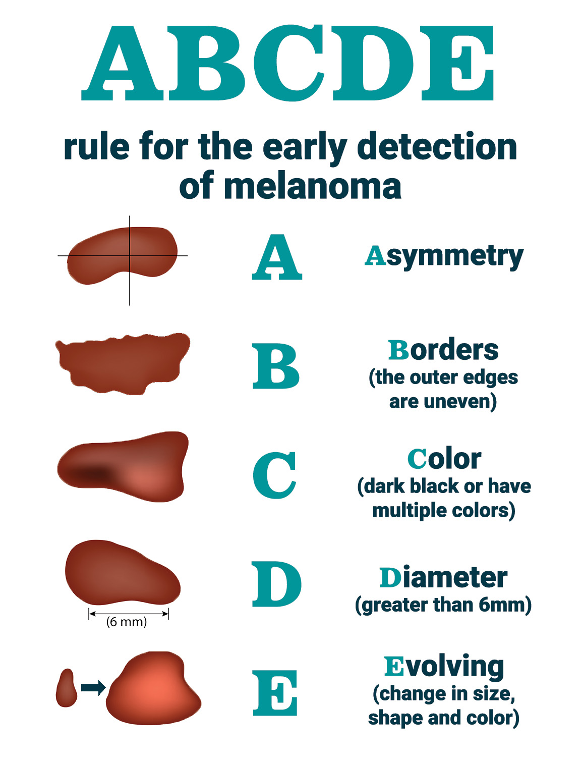 Melanoma Mole Vs Normal Mole Melanoma Mole Vs Normal Mole
