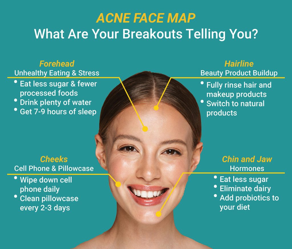 Acne & Rosacea FLDSCC