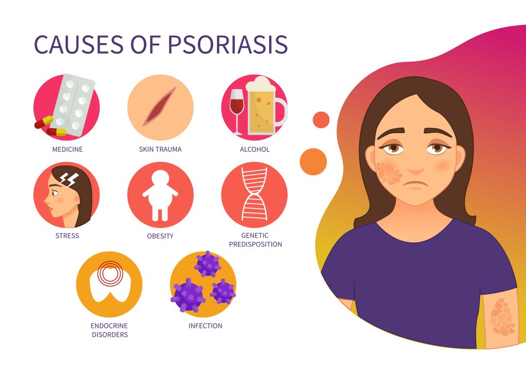 Psoriasis